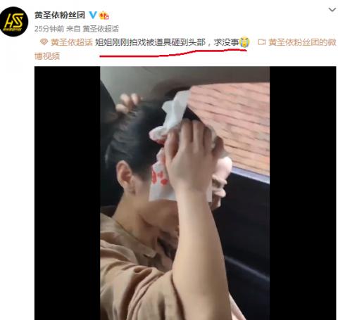 黃圣依拍戲時(shí)頭部受傷怎么回事?黃圣依拍戲時(shí)頭部為什么受傷嚴(yán)重嗎