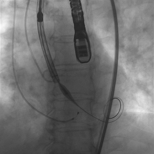 LeftVentricle15fps_12_12.mp4