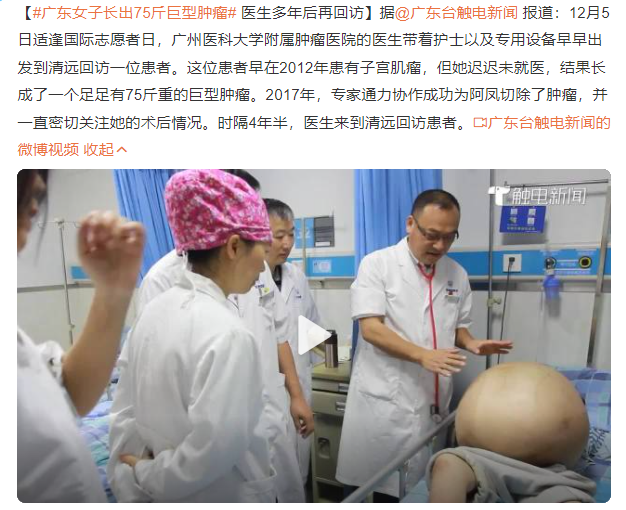 廣東女子長出75斤巨型腫瘤 網(wǎng)友:幸好是良性腫瘤