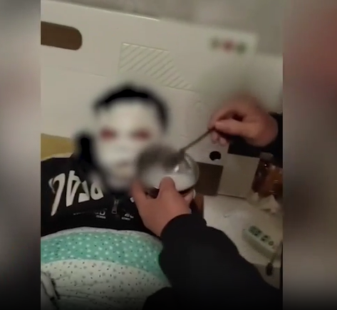 12歲男孩看短視頻學(xué)做火藥被炸傷:臉被炸黑手也被炸腫 目前只能吃稀飯