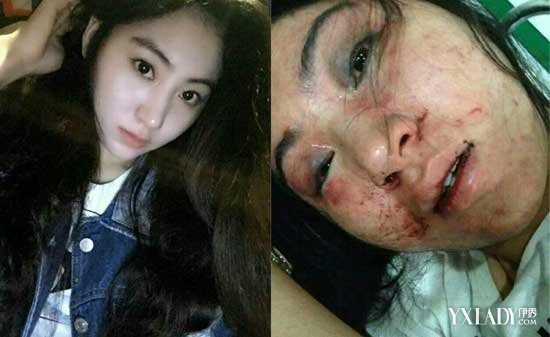 歌手拒陪酒遭老板娘毒打