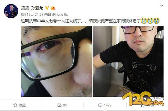 LOL笑笑孫亞龍患眼疾 網(wǎng)友:失去之后才會珍惜 LOL笑笑孫亞龍患眼疾 網(wǎng)友:別等失去之后才會珍惜